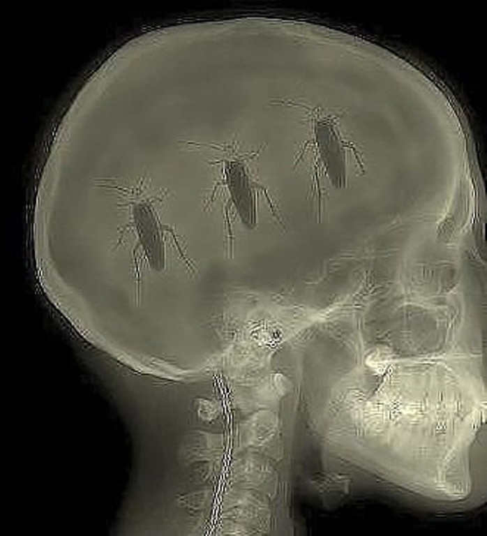 Тараканы в голове