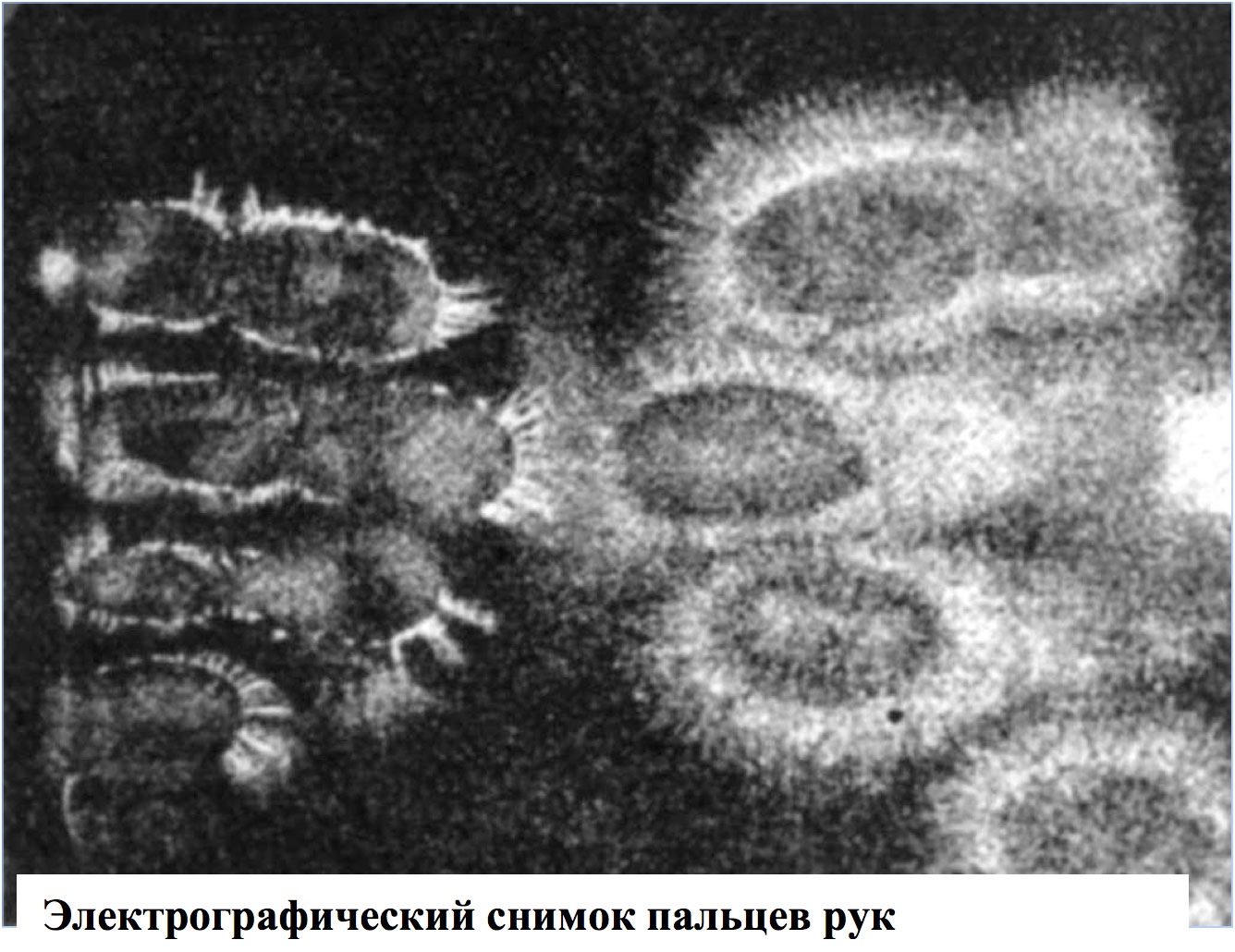 Электрография. Электрографические снимки. Электрографические методы исследования. Изображение электрография.